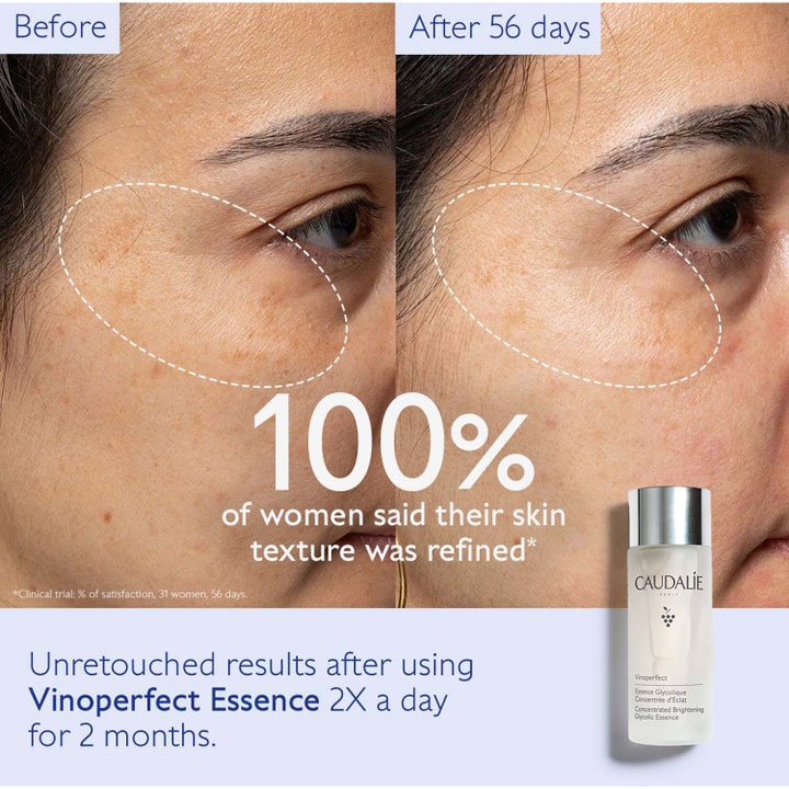 Caudalie Vinoperfect Glycolic Essence 100 ml forbedrer hudstruktur vist med før- og etterbilder av ansiktshud