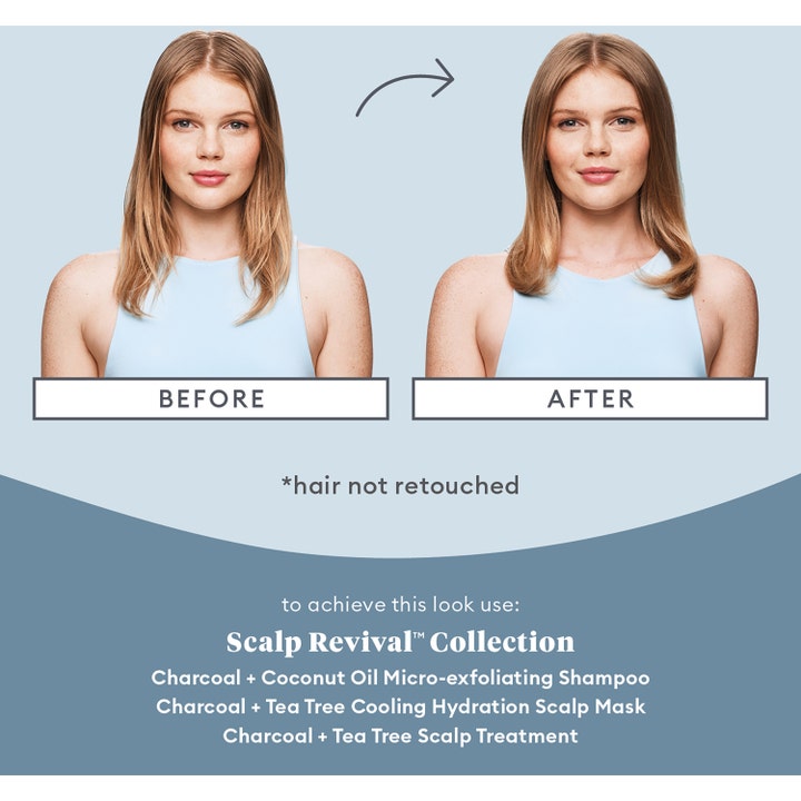Scalp Revival™ Scalp Soothing Solutions Set