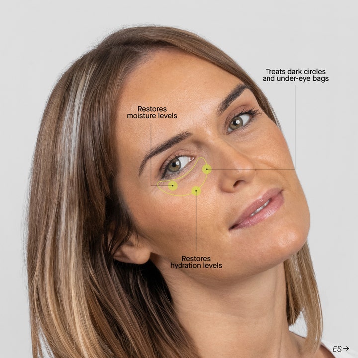 Niche Beauty Lab Transparent Lab Eye-Repair Complex 15 ml øyekrem mot mørke ringer vist på kvinne med infografikk