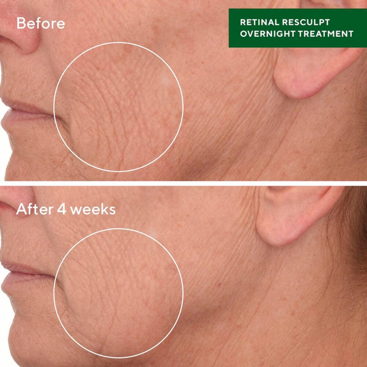 Murad Retinal ReSculpt Treatment 30 ml nattbehandling viser før og etter resultat på rynker etter 4 uker.