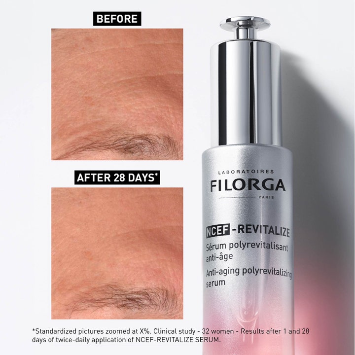Filorga NCEF-Revitalize Serum 30 ml anti-aging serum viser før og etter resultater på huden etter 28 dager