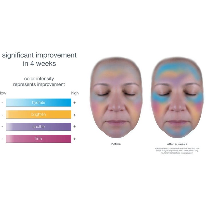 Dermalogica Smart Response Serum Duo hudpleiesett viser før og etter-bilder med økt fukt og fasthet etter 4 uker.
