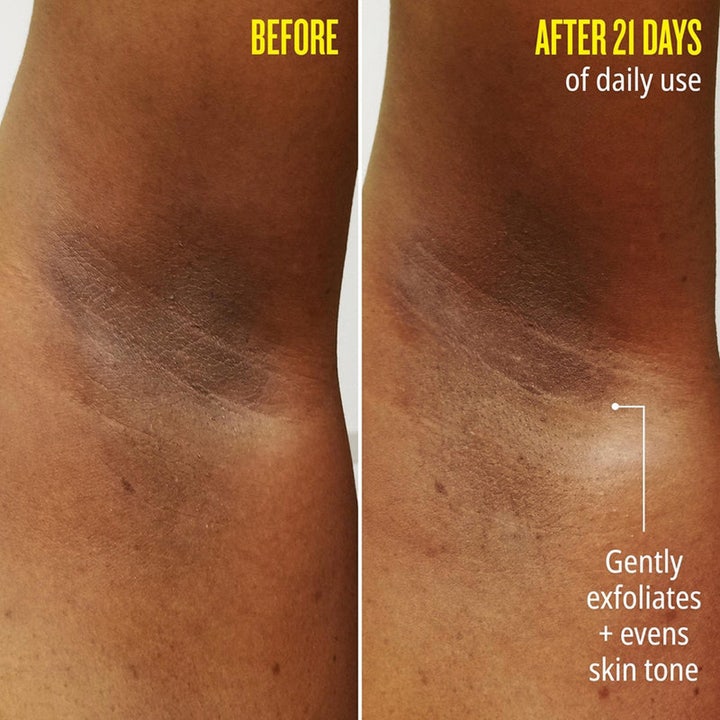 Sol de Janeiro Rio Deo 62 57 g aluminum-free deodorant gir jevnere hudtone vist med før og etter resultat.