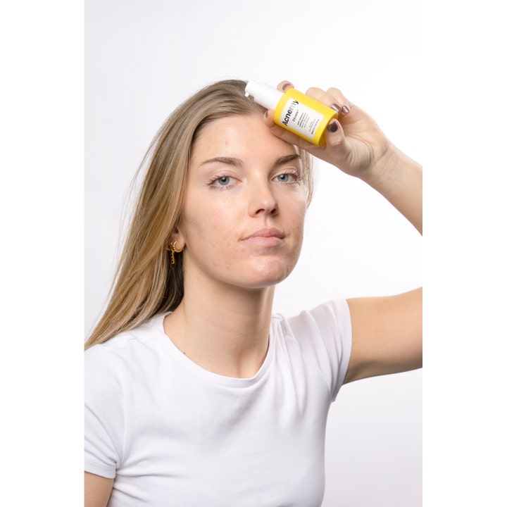 Niche Beauty Lab Acnemy Zitcalm Serum 30 ml beroligende ansiktsserum i en gul pumpeflaske holdt av en kvinne