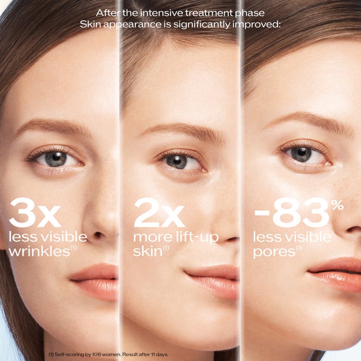Shiseido Bio Performance 2.0 Micro Needle 1,4 ml spot treatment viser resultater med færre rynker og porer.