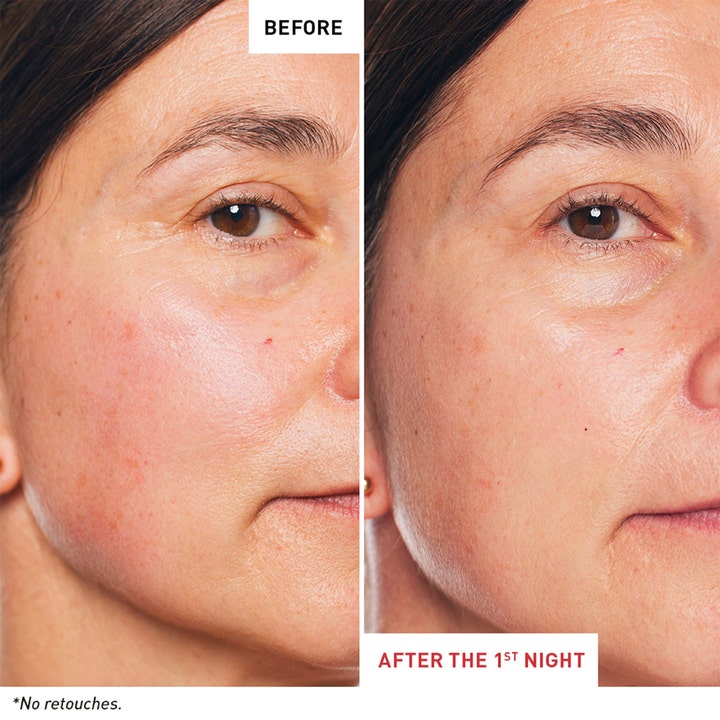 Erborian Skin Therapy Night Oil Serum 30 ml nattserum før og etter bilde som viser jevnere hudtone etter første natt