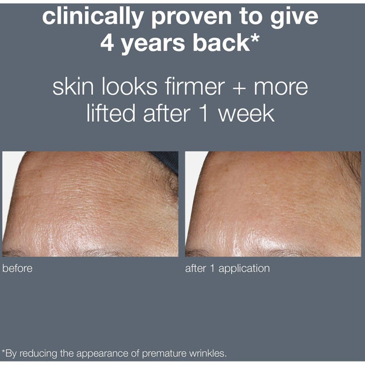 Dermalogica Phyto Nature Oxygen Cream før og etter bilde som viser fastere hud og reduserte rynker i pannen