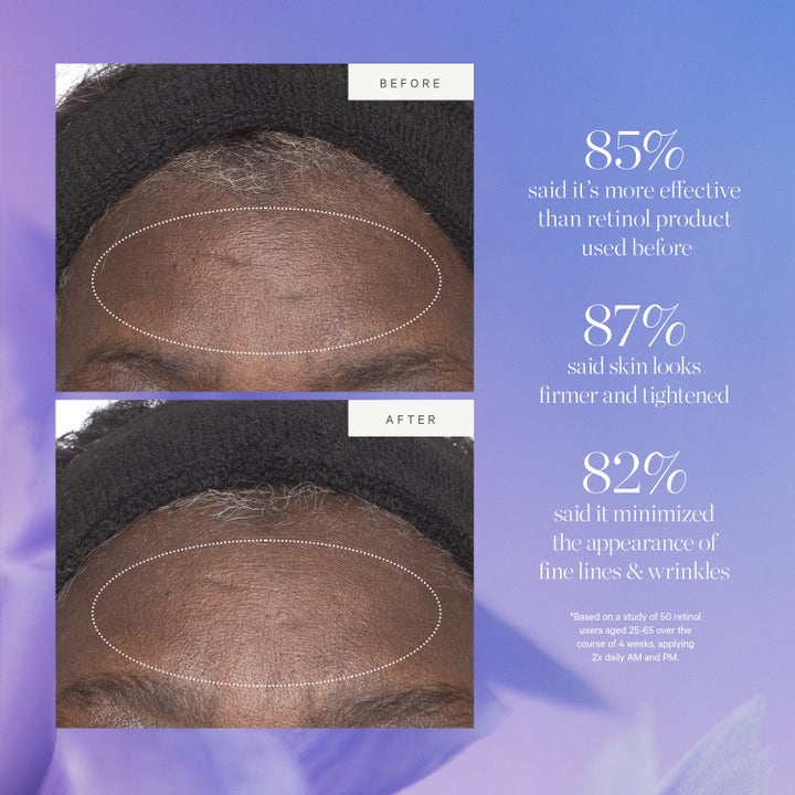 KORA Organics Plant Stem Cell Retinol Alternative Moisturizer 50 ml dagkrem viser før og etter resultat på rynker
