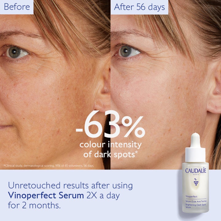Caudalie Vinoperfect Radiance Serum 30 ml mot mørke flekker viser før og etter resultater med redusert fargeintensitet.