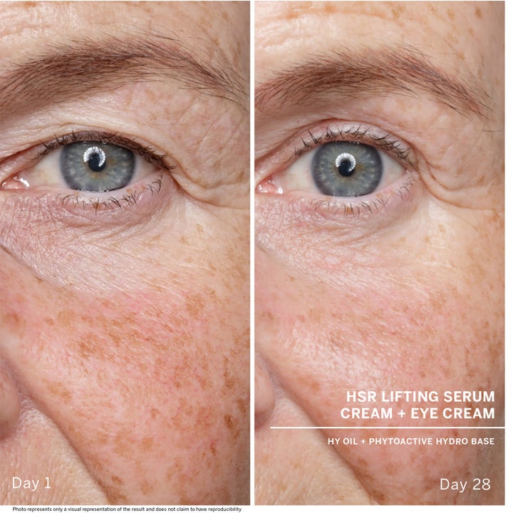 Babor HSR Lifting Serum 30 ml ansiktsserum gir løft og viser reduserte linjer ved øyet fra dag 1 til dag 28.
