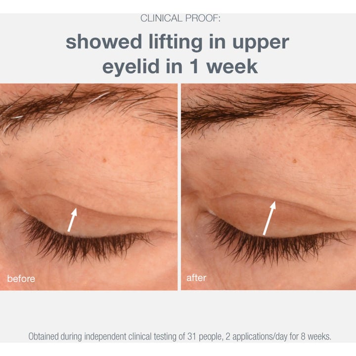 Dermalogica Phyto Nature Lifting Eye Cream før og etter bilde som viser løftende effekt på øyelokk