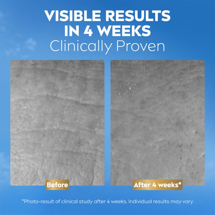 NIVEA Q10 Collagen Expert 50 ml ansiktskrem viser klinisk beviste resultater på hudens tekstur med før og etter bilder