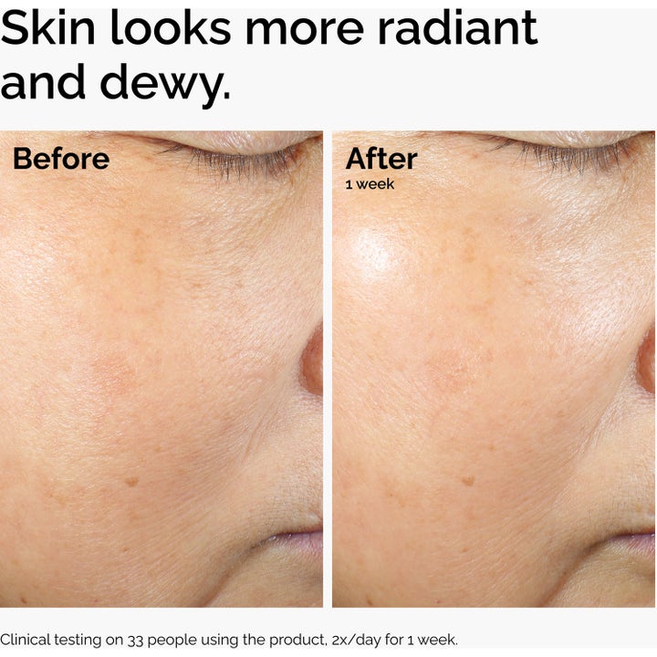 The Ordinary Rice Lipids + Ectoin Microemulsion 60 ml ansiktskrem gir mer strålende og dewy hud i før og etter-bilder.