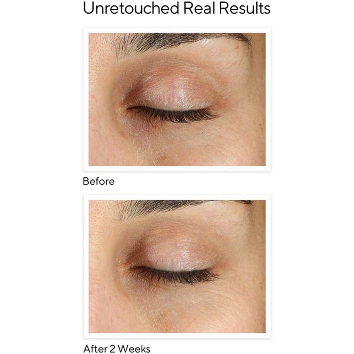 Murad Environmental Shield Vita-C Eyes 15 ml øyekrem viser før- og etterresultat på mørke ringer etter to uker.