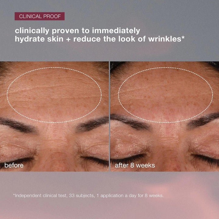 Dermalogica Dynamic Skin Recovery og Retinol Serum 80 ml hudpleie viser kliniske før og etter resultater på rynker