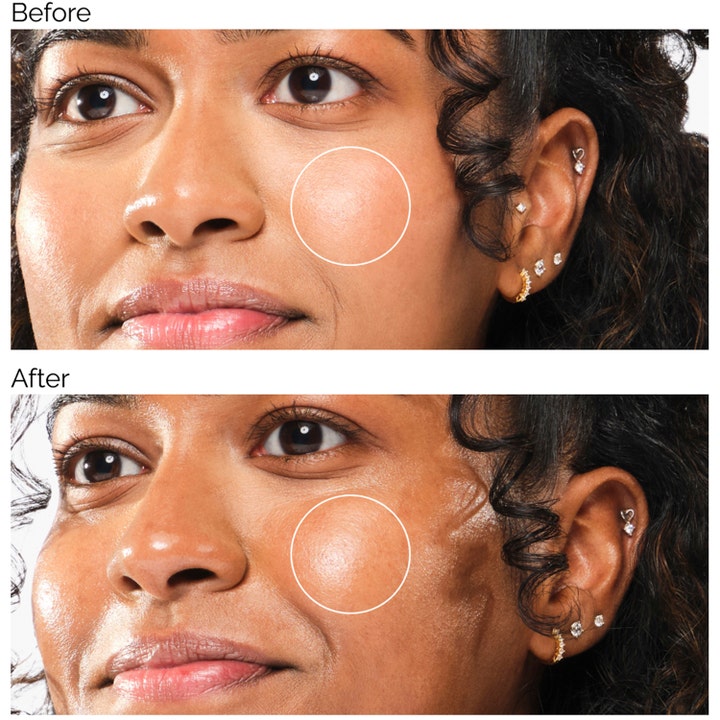 The Ordinary UV Filters SPF45 Serum 60 ml gir fuktig glød i en før og etter sammenligning av hudens tekstur.